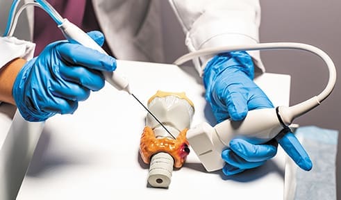 Doctor using RFA tool to examine thyroid prop