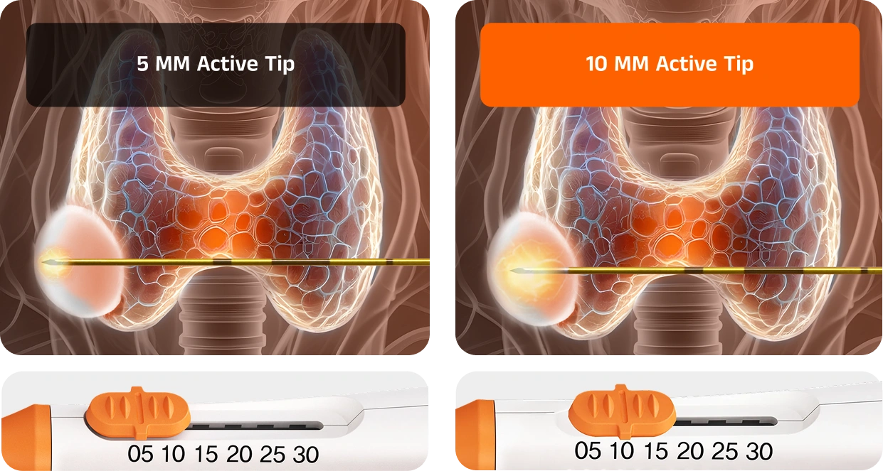 Diagram illustrating the STARMED America VIVA II RF electrode treating multiple thyroid nodules of varying sizes and ablation zone configurations
