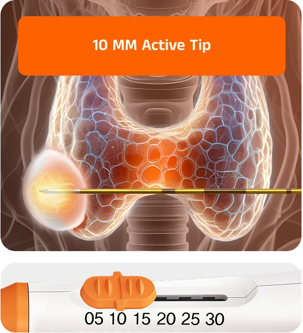 Diagram illustrating the VIVA II RF electrode creating varying ablation zone sizes